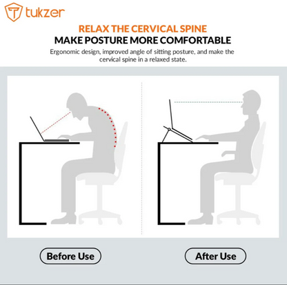 Adjustable Aluminium Laptop Stand – Foldable, Ergonomic &amp; Portable (Up to 17”)