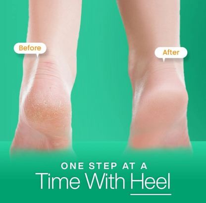 Silicone Gel Heel Socks – Moisturizing, Pain Relief &amp; Crack Repair (Free Size, Unisex)